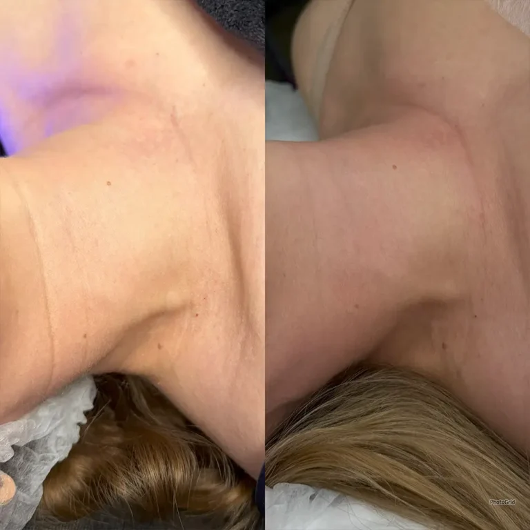 8h